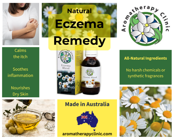Natural remedy to soothe eczema and dermatitis